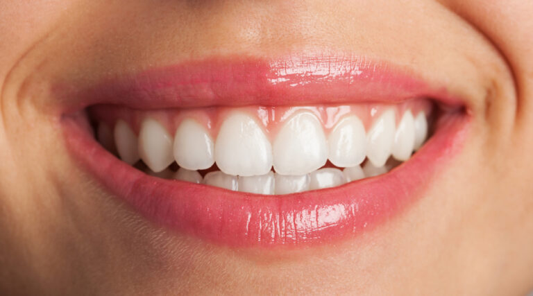 Foods for Healthy Gums and Teeth in Broomfield