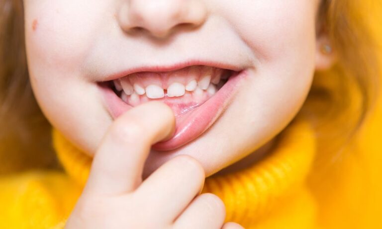 Keep Your Children’s Gums Healthy: Pediatric Periodontal Care Tips for Broomfield Parents