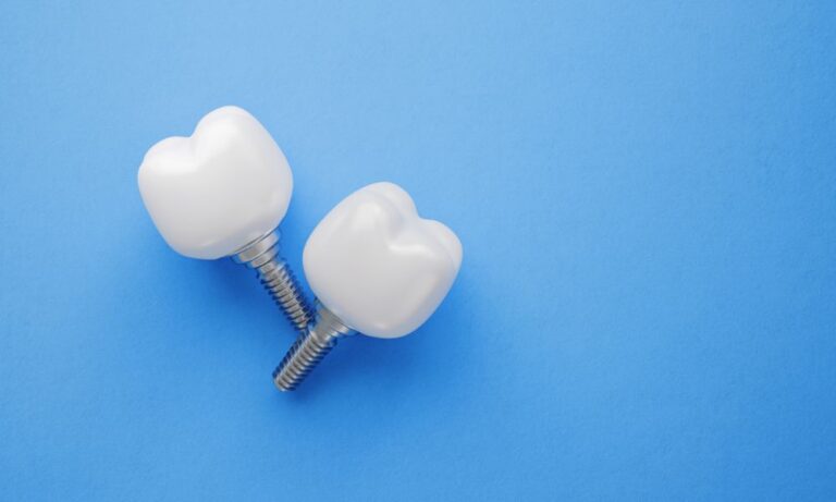 The Complete Guide to Dental Implants for Northglenn Locals
