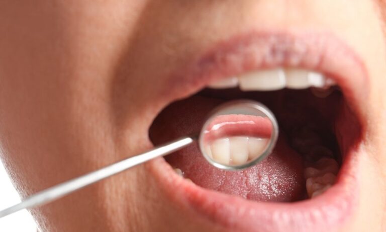 Oral Cancer Screening: A Look into the Process and Why It’s Important