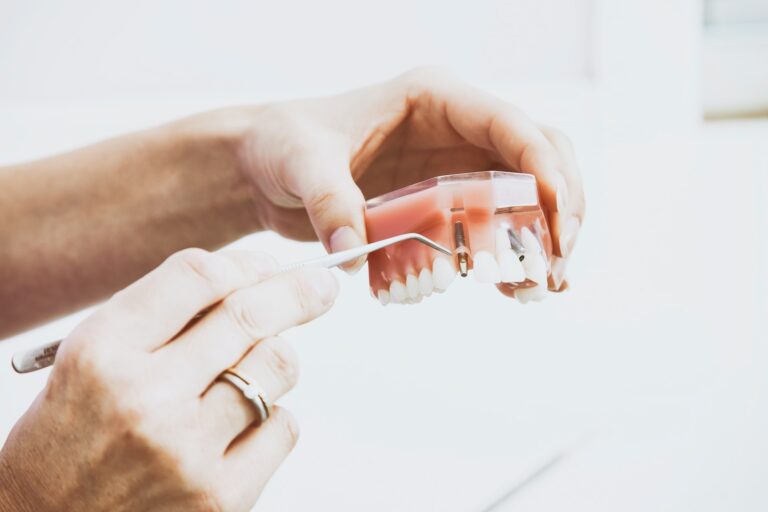 Dental Implants: A Comprehensive Guide and Their Benefits