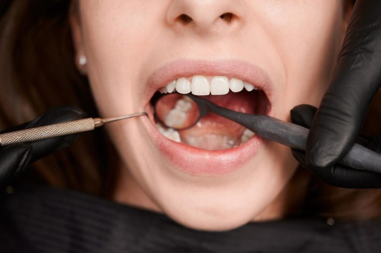 Combating Gingivitis: Strategies for Prevention and Treatment of Early Gum Disease