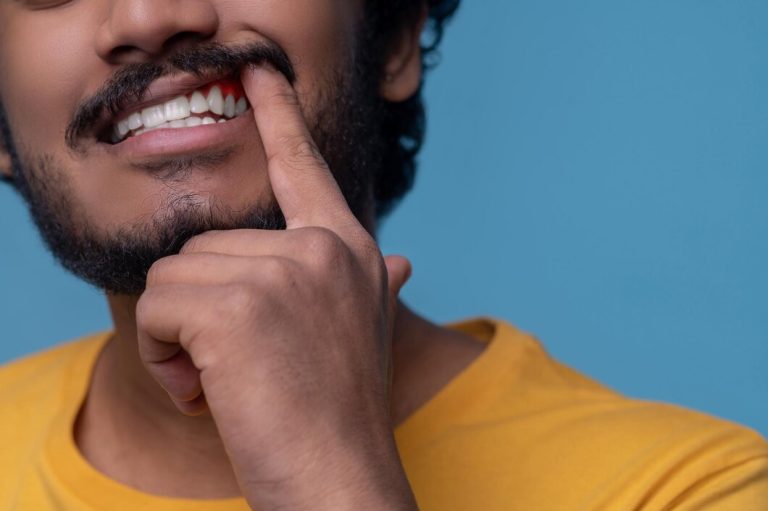 adult man showing his periodontal disease before camera 259150 57666